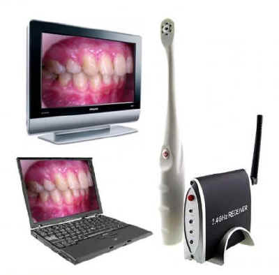 Microtelecamera wireless odontoiatrica per ispezione denti, bocca, gola